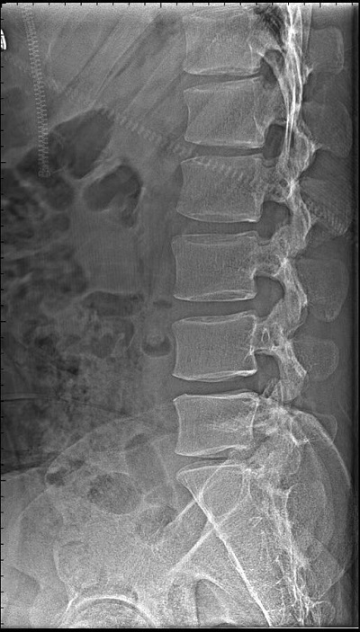 怎么才能選購好醫(yī)用高清攝像機(jī)