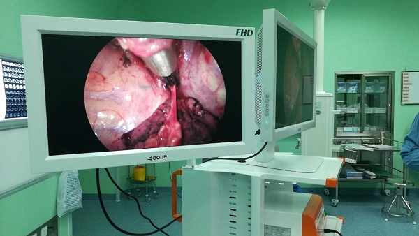 醫(yī)用攝像機選購要多少錢